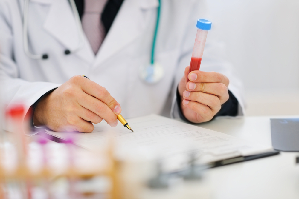 En standard biokemisk blodprøve inkluderer et antal indikatorer, der tages med i aggregatet