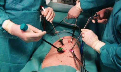 I forsømte kliniske tilfælde af rygsøjlesygdomme udføres kirurgisk indgreb